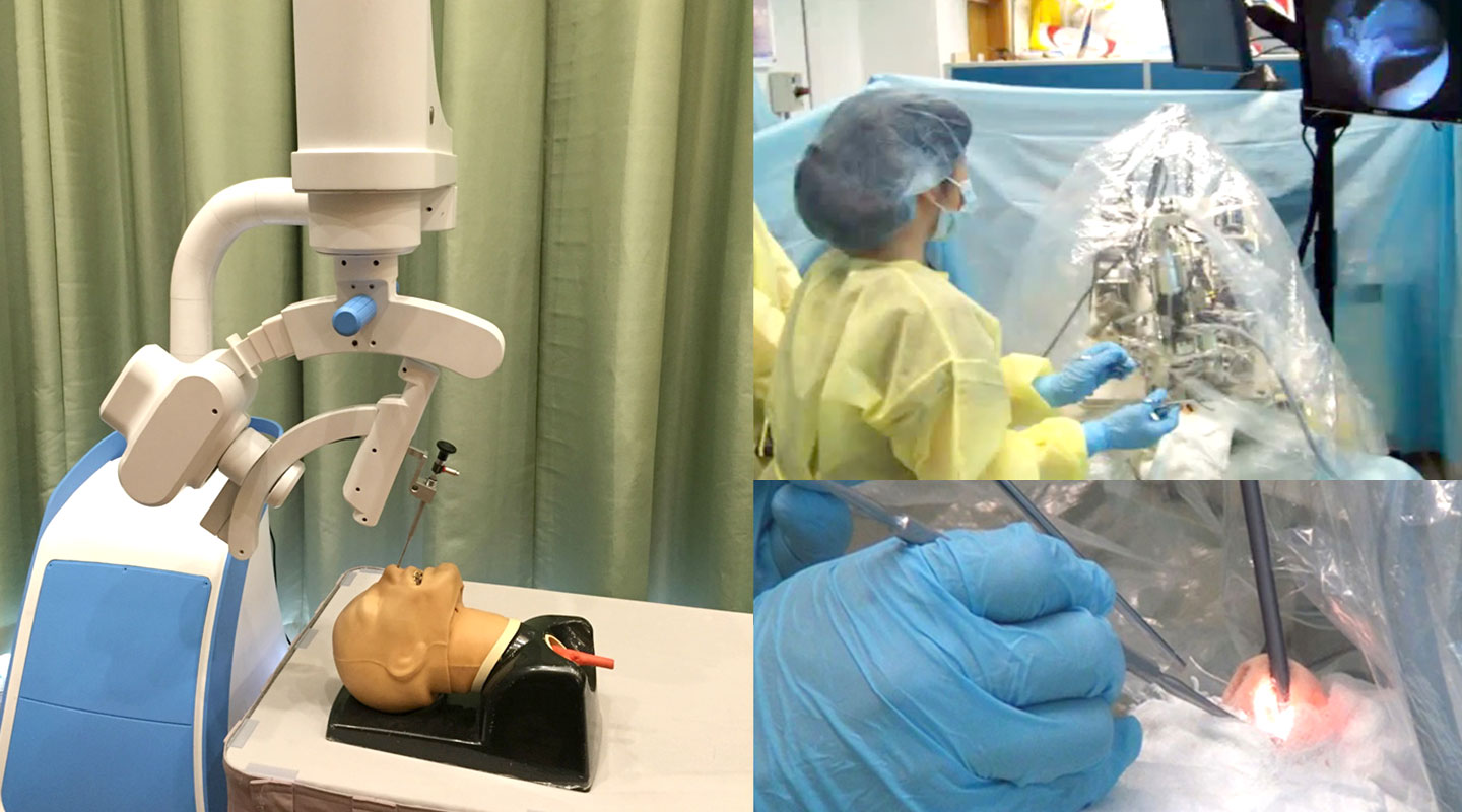 One surgery robot helps with nasal surgery by maneuvering an endoscope mechanically