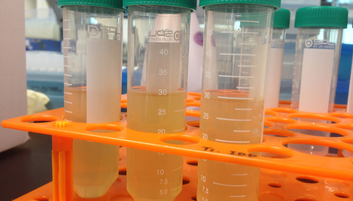 Collected stool is diluted with sterile saline and filtered, and the remaining solution resembles weak tea