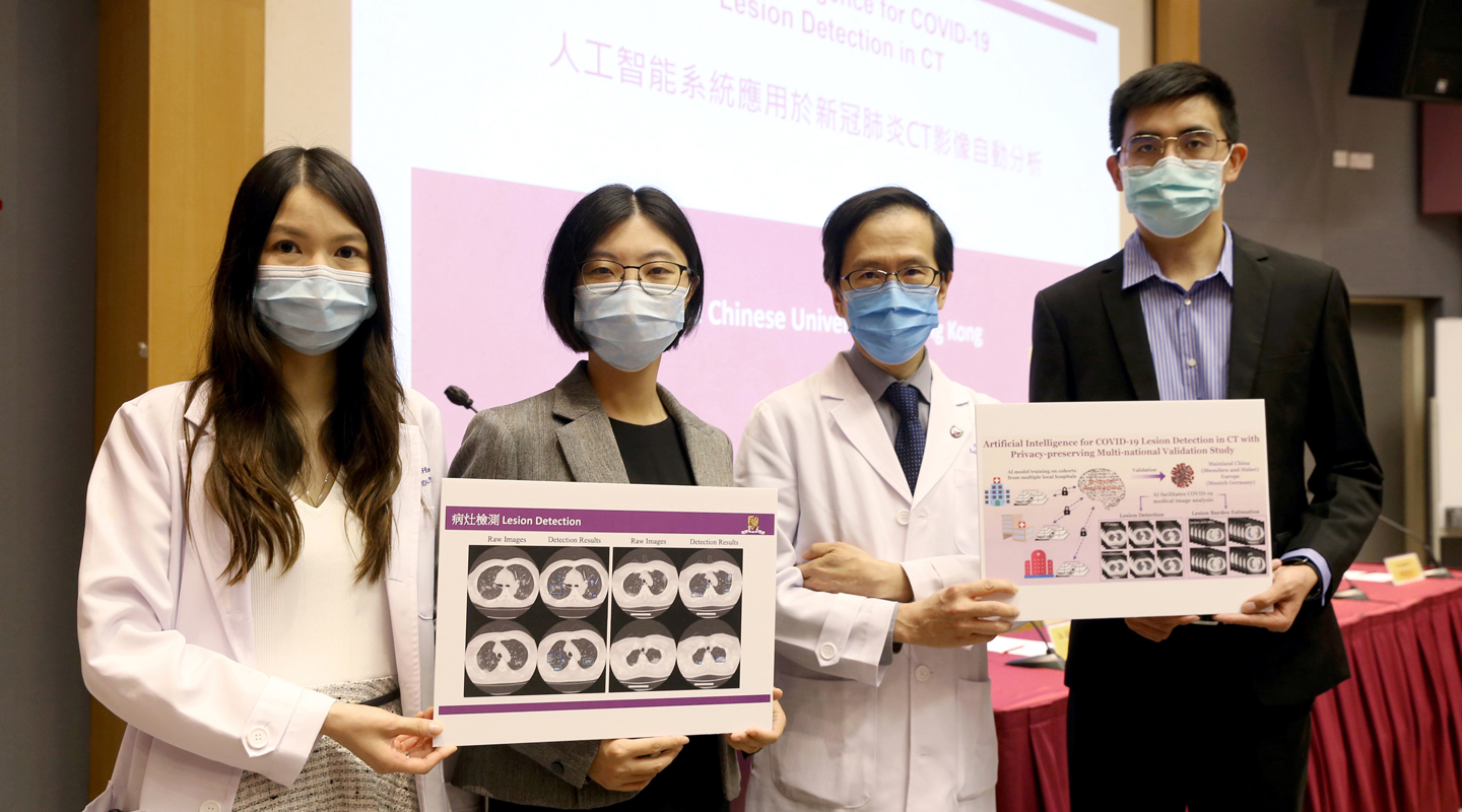 (From left) Dr. Tiffany So, Prof. Dou Qi, Prof. Simon Yu and Mr. Liu Quande