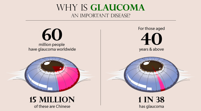 Why is glaucoma an important disease?