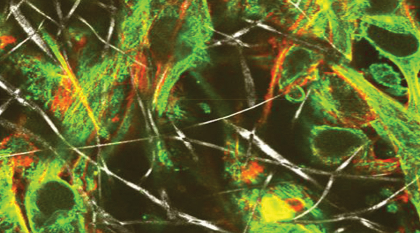 <em>Picture 1:</em> Seeded stem cells (green and red) interact with nanofibrous scaffold (white)