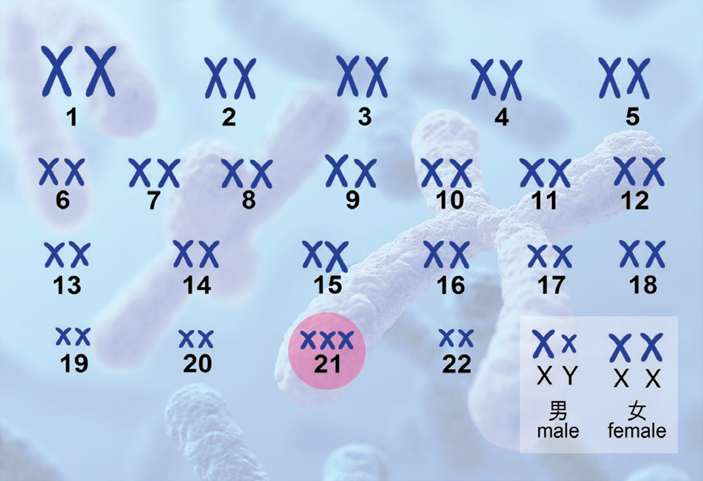 透過檢驗孕婦血漿內胎兒基因的21號染色體，若發現多了一條染色體，便可確診嬰兒患上唐氏綜合症