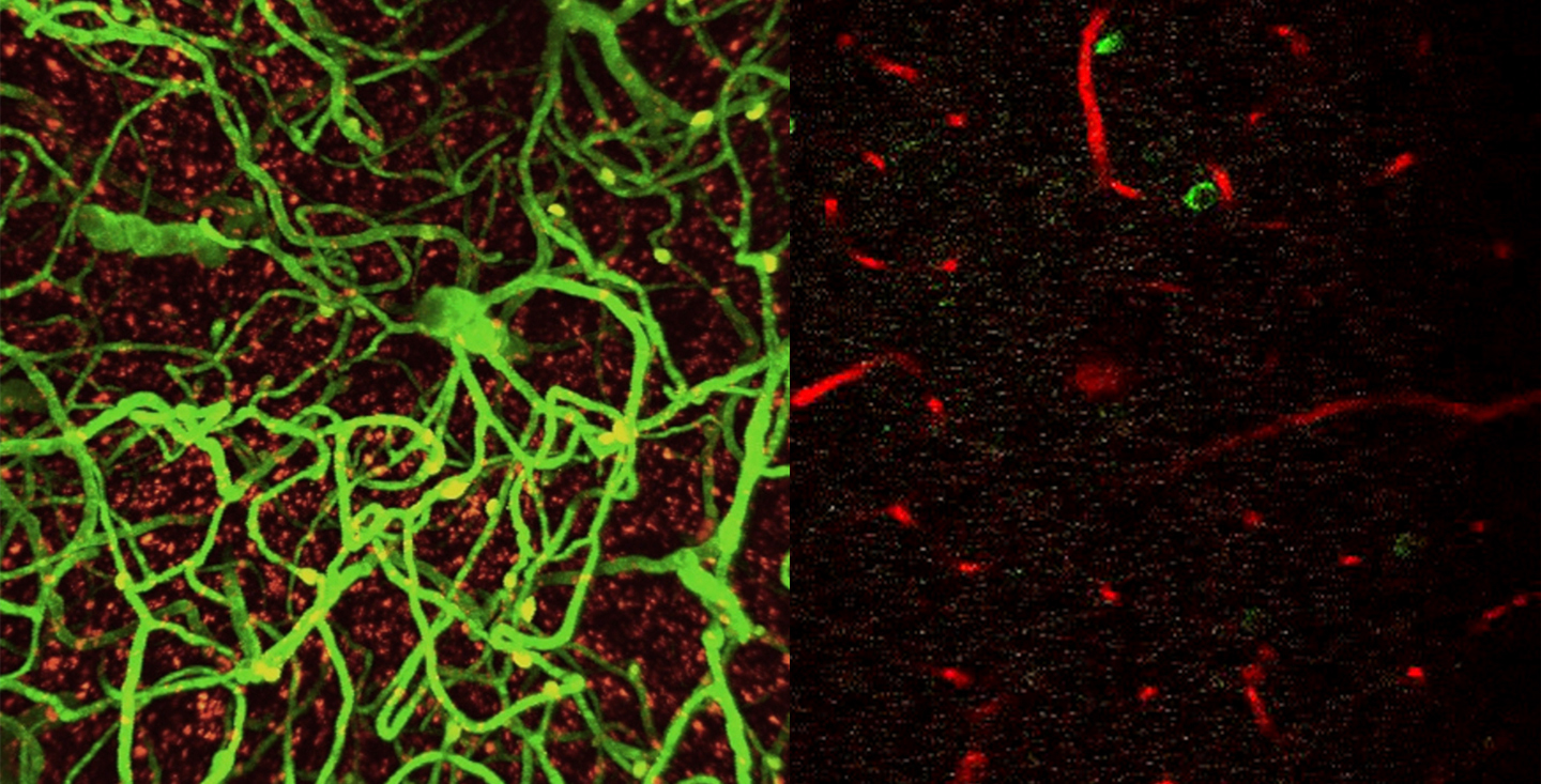 透過分析血腦屏障的完整性（左）、神經血管耦合（右）及進行體內功能研究，高教授發現糖尿病藥物或有助逆轉退化