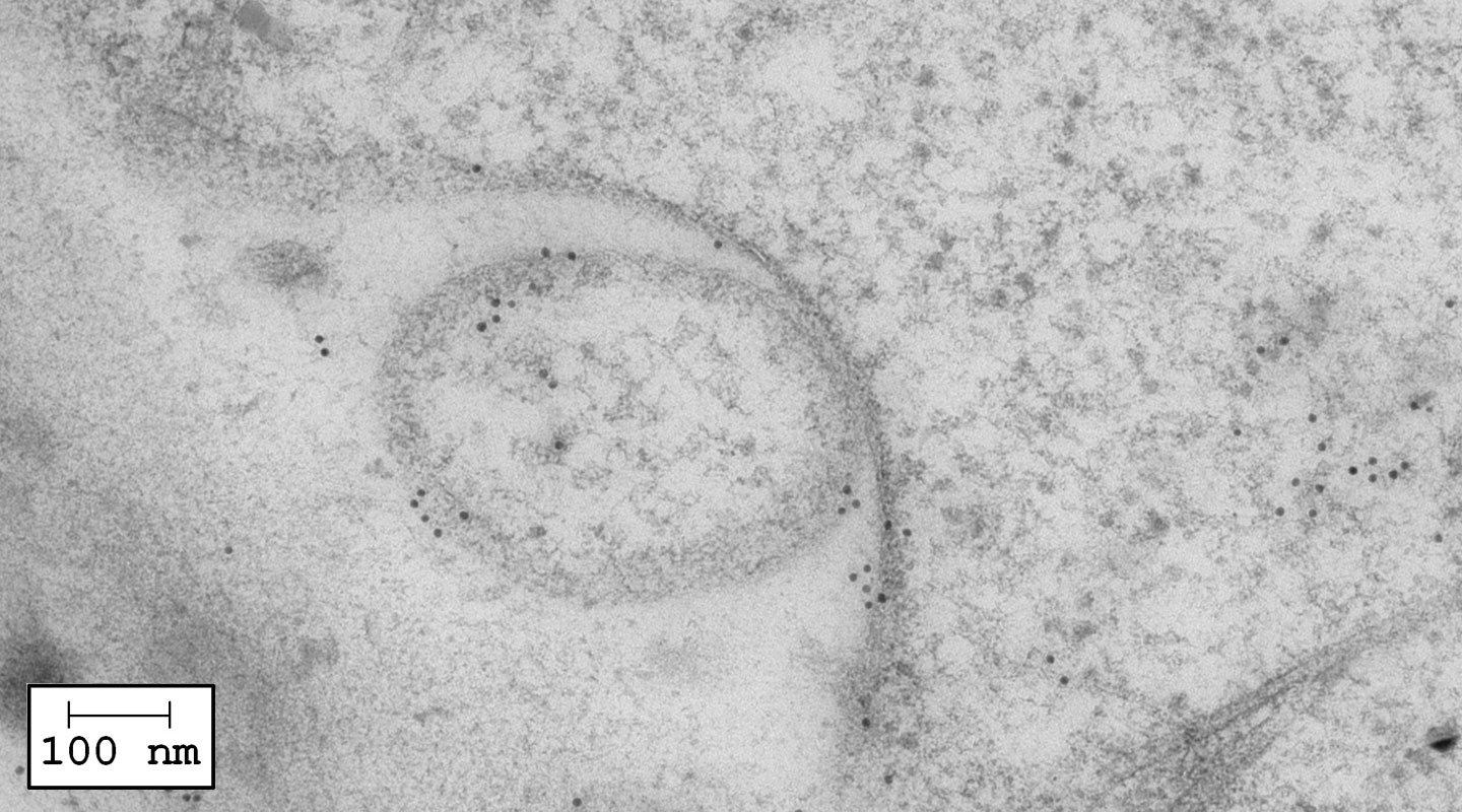 EXPO outside the plasma membrane just before releasing its protein cargo; tiny black dots indicate presence of proteins in EXPO