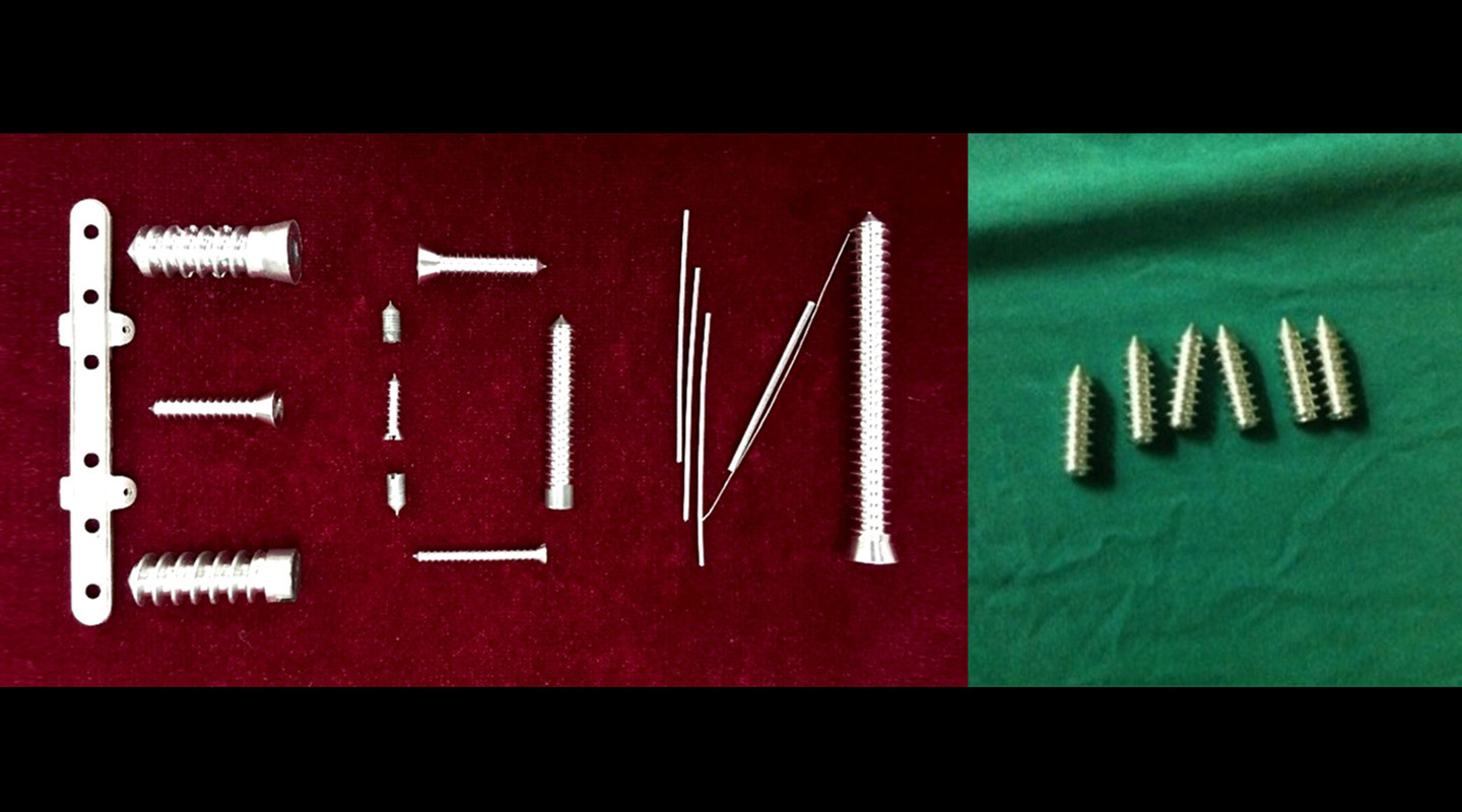 High-purity magnesium screws, nails and plates